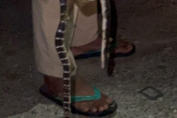 बर्खासङ्गै सर्पदंशको त्रास , महाकाली अस्पतालमा दैनिक ४-५ जना उपचाररत